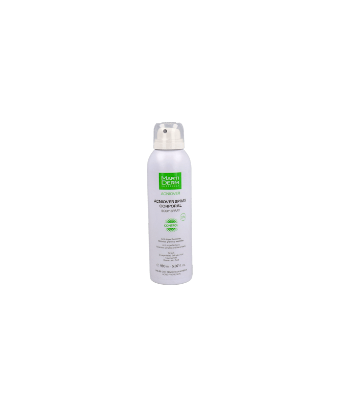 ACNIOVER SPRAY CORPORAL 150 ML – foto del producto cada acniover spray